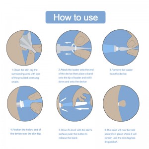 Auto Band Non Toxic Face Care Mole Wart Tool For Small To Medium Blue Skin Tag Removal Kit With Cleansing Swabs Home Use Adult