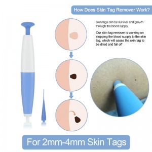 Auto Band Non Toxic Face Care Mole Wart Tool For Small To Medium Blue Skin Tag Removal Kit With Cleansing Swabs Home Use Adult